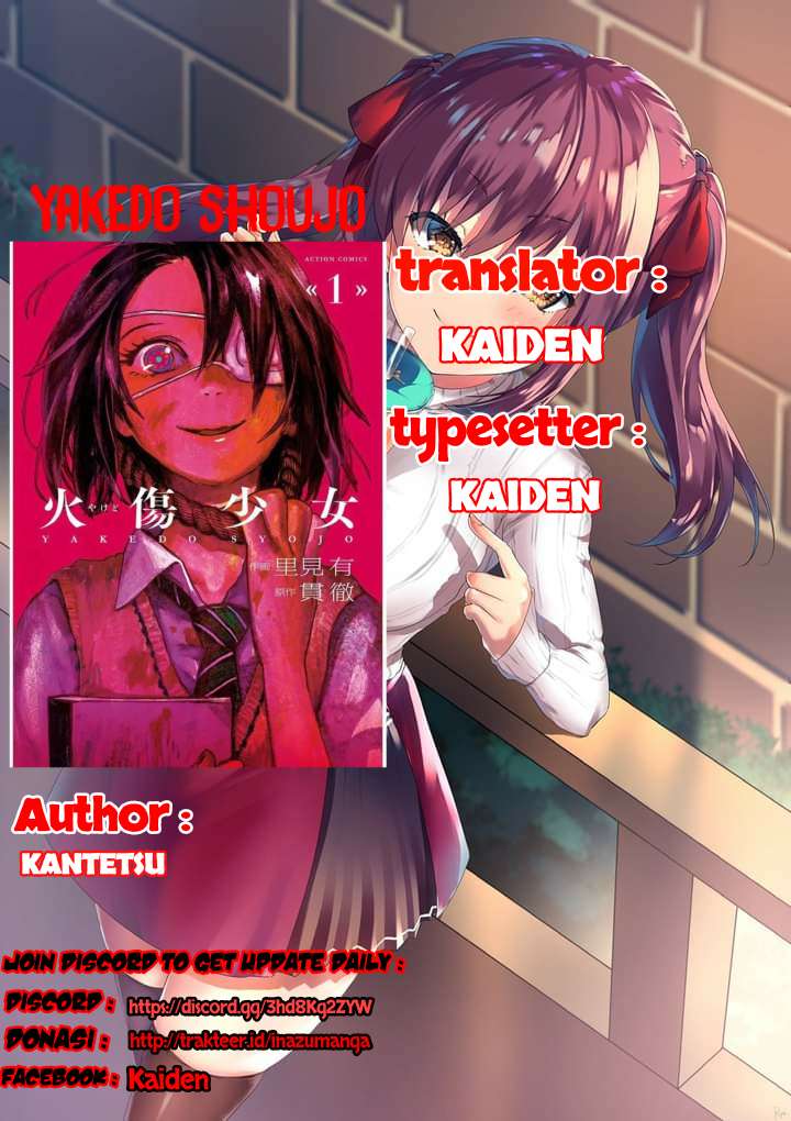 Yakedo Shoujo Chapter 04 Gambar 1